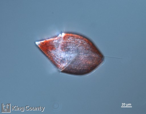 Photo of Gyrodinium spp.